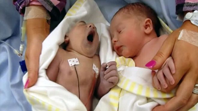 Bebê que viveu apenas 100 minutos é doador mais jovem na Grã-Bretanha