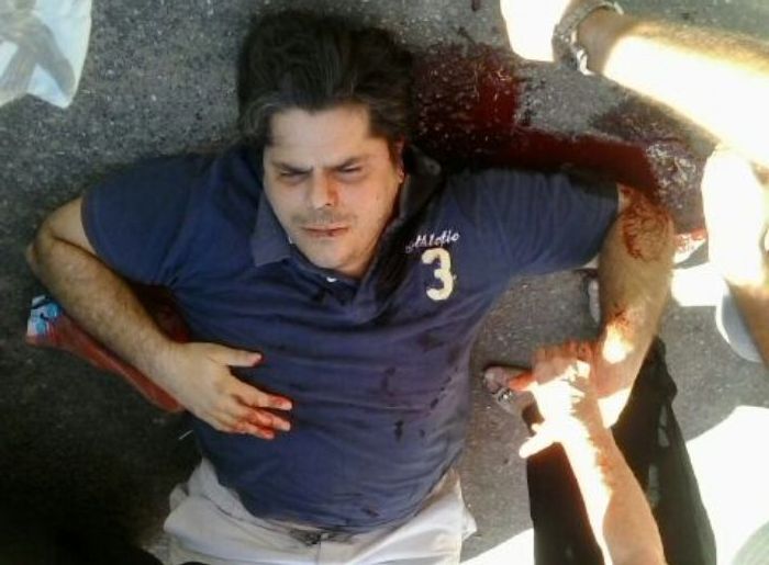 MUITO GRAVE: Piora estado de saúde de delegado baleado no Sertão