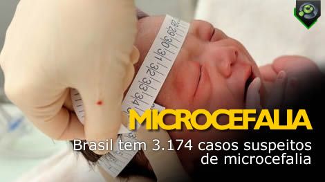 Brasil tem 3.174 casos suspeitos de microcefalia