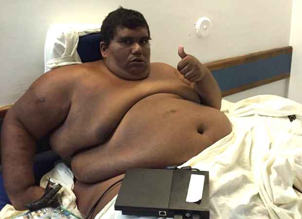 Paraibano Carlinhos recebe alta de Hospital após emagrecer mais de 150 quilos