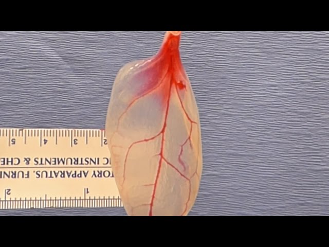 VEJA VÍDEO – Cientistas demonstram método que transforma espinafre em tecido de coração humano