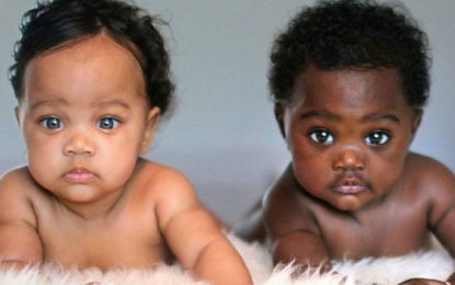 Gêmeas de cor de pele diferente fazem sucesso na internet