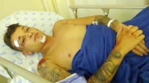 VEJA VÍDEO: MC Gui sofre acidente de moto no litoral de São Paulo